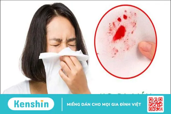 Ung thư phổi giai đoạn cuối sống được bao lâu? Cách chăm sóc bệnh nhân