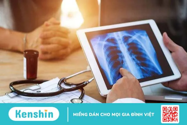 Ung thư phổi giai đoạn cuối sống được bao lâu? Cách chăm sóc bệnh nhân