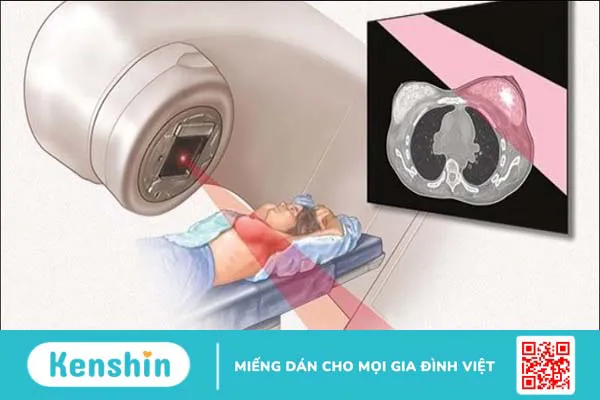 Ung thư vú nên ăn gì và kiêng ăn gì? Lời khuyên dành cho người bệnh