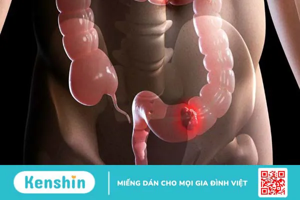 Uống mật ong hàng ngày có tốt không?