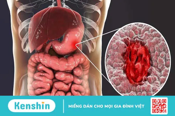 Uống mật ong hàng ngày có tốt không?