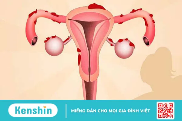 Vì sao bị đau rát khi quan hệ tình dục và cách khắc phục hiệu quả