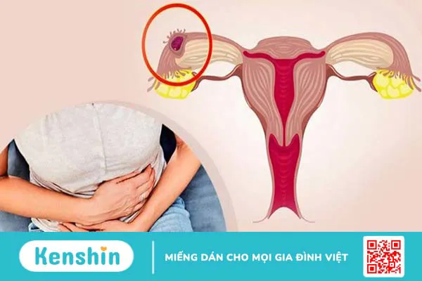 Vì sao bị đau rát khi quan hệ tình dục và cách khắc phục hiệu quả