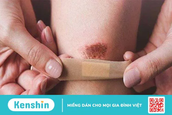 Vì sao nên bổ sung Lysine cho trẻ? Cách bổ sung lysine cho trẻ đúng cách