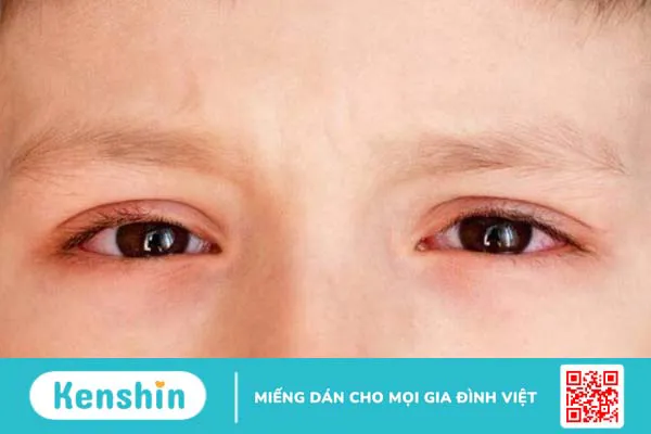 Vì sao nên bổ sung Lysine cho trẻ? Cách bổ sung lysine cho trẻ đúng cách