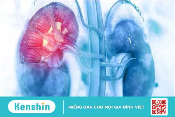 Vị trí thận nằm ở đâu trong cơ thể? Cấu tạo và chức năng của thận