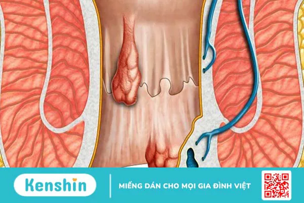 Virus HPV có thể gây ra bệnh gì?