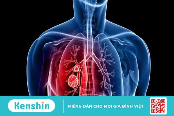 Vitamin B2 là gì? Công dụng, liều dùng vitamin B2 an toàn, hiệu quả