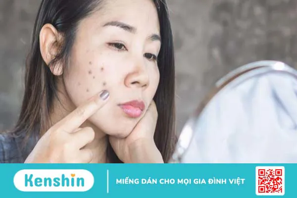 Vitamin B3 có tác dụng gì cho da? 11 công dụng trên da của vitamin B3