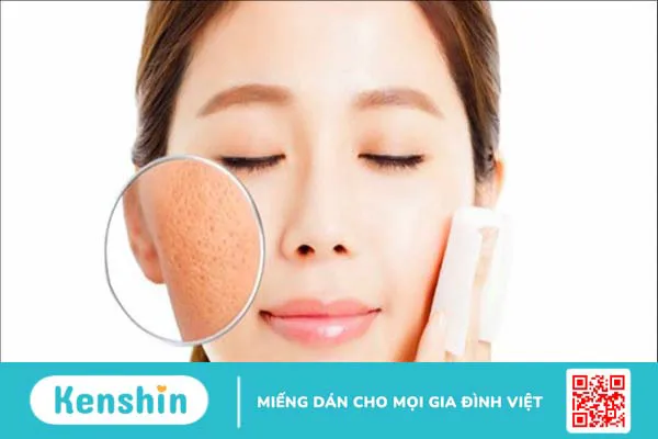 Vitamin B3 có tác dụng gì cho da? 11 công dụng trên da của vitamin B3