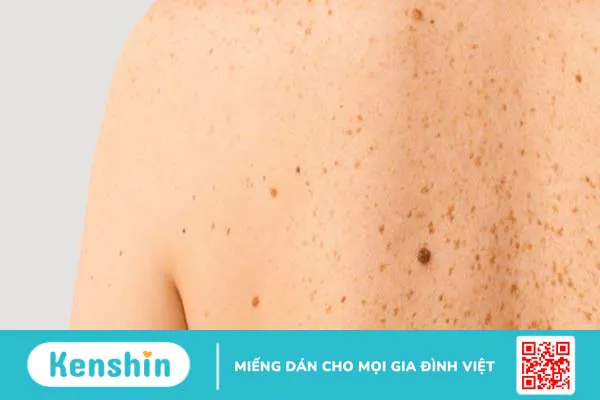 Vitamin B3 có tác dụng gì cho da? 11 công dụng trên da của vitamin B3