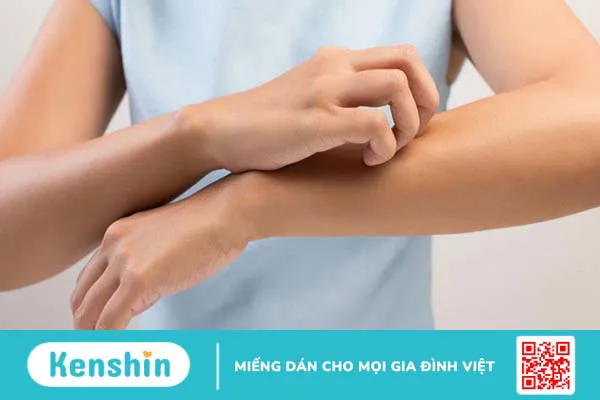 Vitamin B5 là gì? Tác dụng, cách dùng, thực phẩm chứa vitamin B5