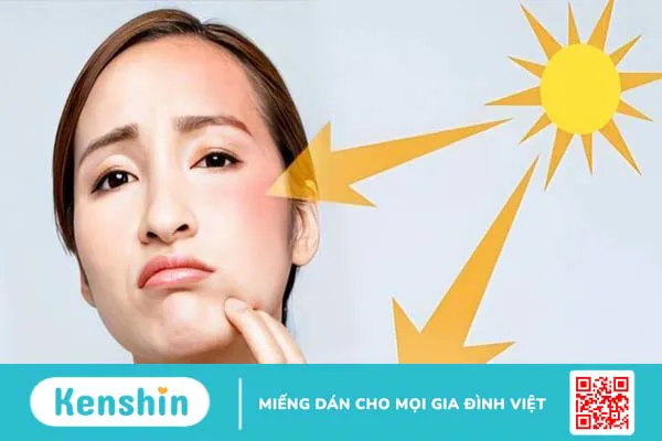 Vitamin E có giúp trắng da không? Cách làm trắng da bằng vitamin E