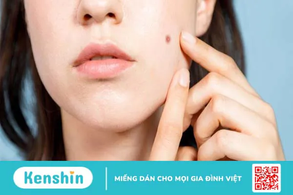 Vitamin E có giúp trị sẹo không? Vai trò của vitamin E với làn da