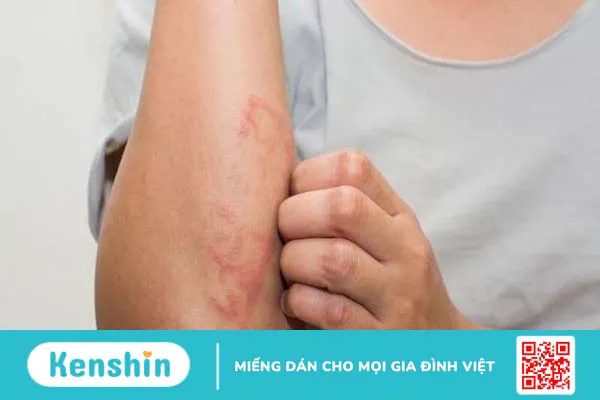 Vitamin E có tác dụng gì? 13 công dụng của vitamin E với sức khỏe