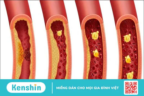 Vitamin K2 là gì? Công dụng, liều dùng và tác dụng phụ khi sử dụng