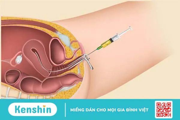 Vô sinh ở nam giới có chữa được không? 8 cách chữa vô sinh ở nam giới bạn nên biết