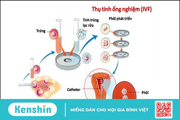 Vô sinh ở nam giới có chữa được không? 8 cách chữa vô sinh ở nam giới bạn nên biết