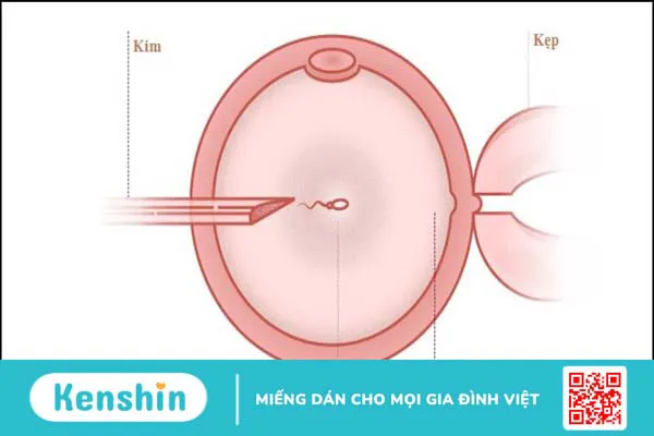 Vô sinh ở nam giới có chữa được không? 8 cách chữa vô sinh ở nam giới bạn nên biết