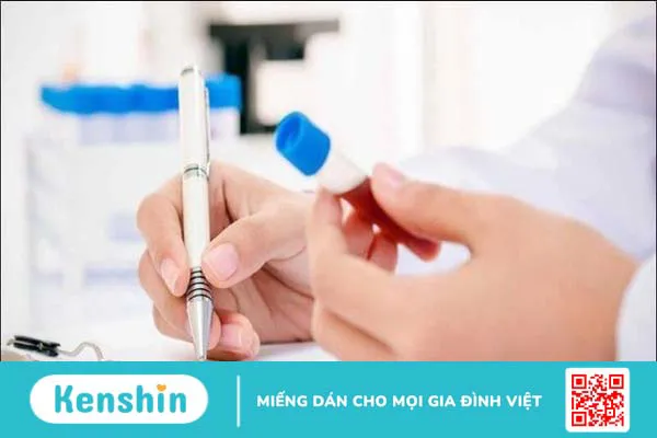 Xét nghiệm định lượng sắt tự do trong huyết thanh là gì?