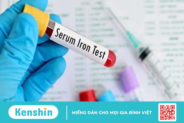 Xét nghiệm định lượng sắt tự do trong huyết thanh là gì?