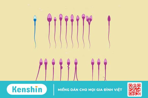 Xét nghiệm tinh dịch đồ là gì? Phân tích kết quả xét nghiệm – Xem ngay