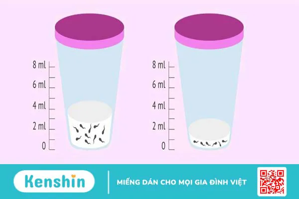 Xét nghiệm tinh dịch đồ là gì? Phân tích kết quả xét nghiệm – Xem ngay