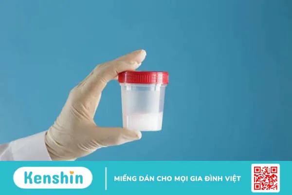 Xét nghiệm tinh dịch đồ là gì? Phân tích kết quả xét nghiệm – Xem ngay