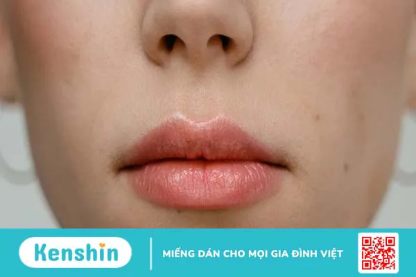 Xì mũi ra máu là bệnh gì? Có nguy hiểm không?