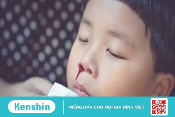 Xì mũi ra máu là bệnh gì? Có nguy hiểm không?