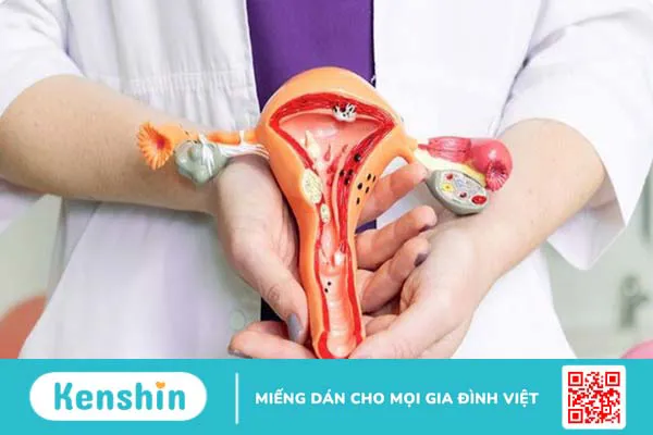 10 cách chữa viêm âm đạo tại nhà an toàn, hiệu quả và cách phòng ngừa