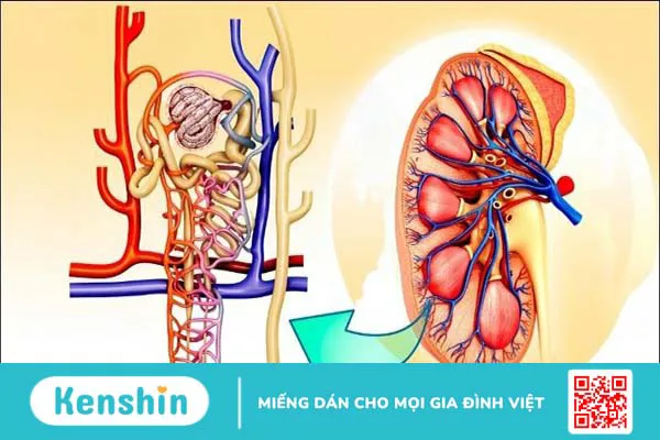 12 dấu hiệu cảnh báo bệnh thận và các thực phẩm nên ăn