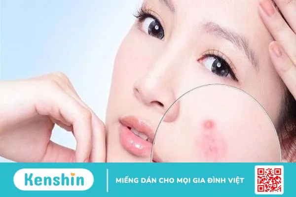 13 sai lầm khi rửa mặt khiến da nổi mụn, lão hóa sớm chị em nên tránh