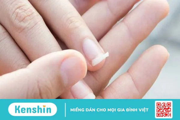 14 mẹo giúp móng tay chắc khỏe bạn nên bỏ túi ngay