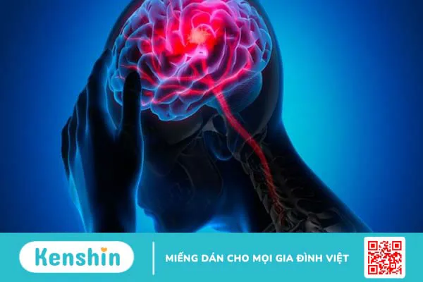 16 di chứng sau đột quỵ thường gặp và các biện pháp phòng ngừa đột quỵ