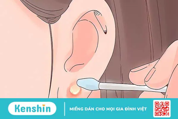 4 dấu hiệu nhiễm trùng khi bấm lỗ tai cần lưu ý kịp thời