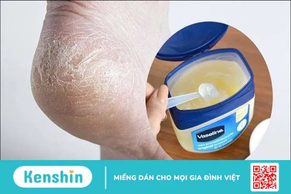 5 cách trị nứt gót chân bằng vaseline tại nhà đơn giản và hiệu quả