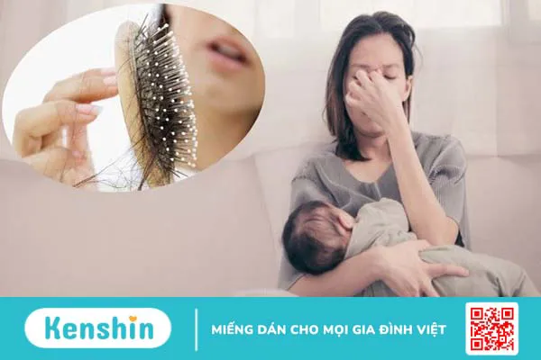 5 cách trị rụng tóc sau sinh an toàn, hiệu quả cho mẹ bỉm sữa