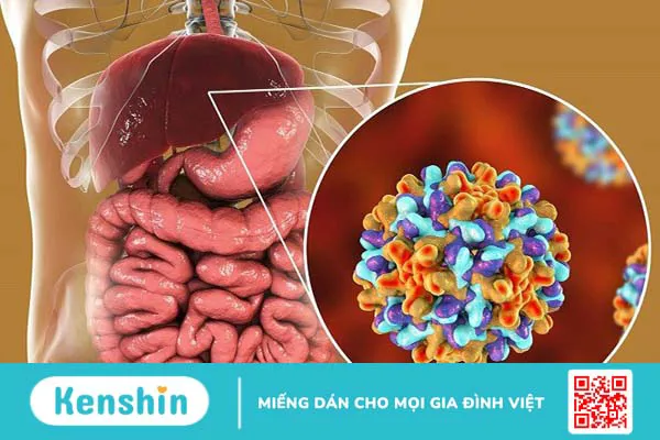 6 bệnh lây qua đường tiêu hoá phổ biến và các nguyên nhân điển hình