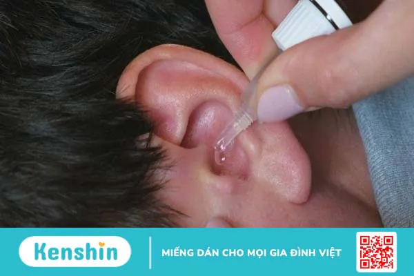 7 cách lấy ráy tai an toàn và đơn giản bạn cần biết