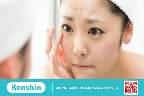 9 cách làm đẹp với đá lạnh bạn nên bỏ túi ngay