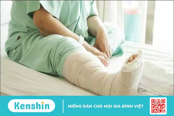 9 lời khuyên cho bệnh nhân bị gãy xương chân bạn không nên bỏ qua