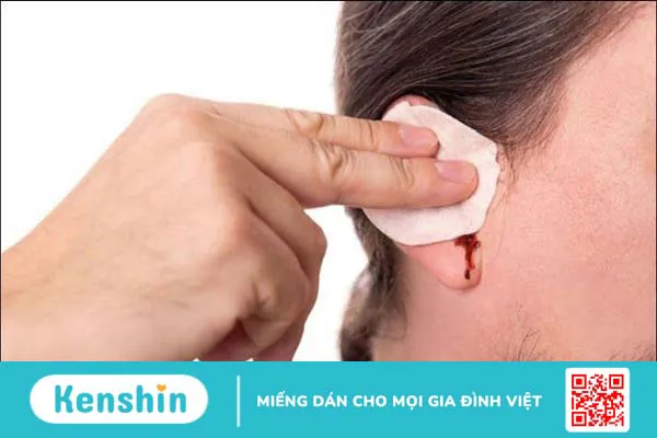 Bị chảy máu tai là bệnh gì? 6 nguyên nhân chảy máu tai bạn nên biết