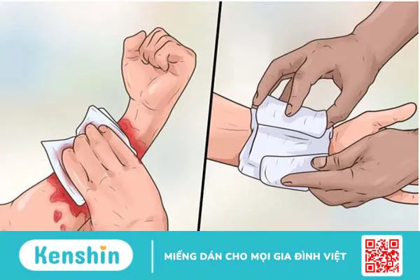 Bị chó cắn nên làm gì? Cách xử lý vết thương khi bị chó cắn