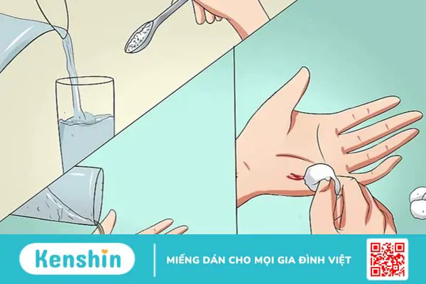 Cách chăm sóc vết thương mau lành, không để lại sẹo