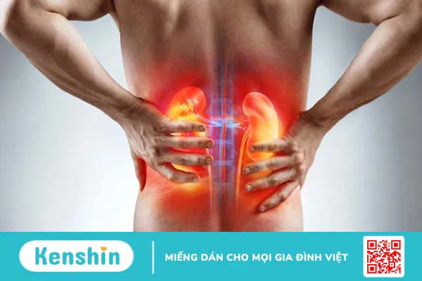 Cảnh báo 8 dấu hiệu sỏi thận có thể bạn chưa biết