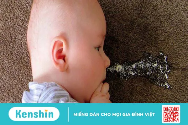 Cảnh báo: Bé sốc phản vệ do uống sữa