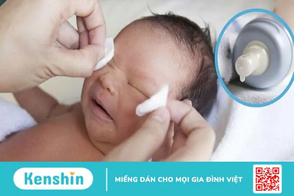 Cảnh báo nguy hiểm khi nhỏ sữa mẹ trực tiếp vào mắt của trẻ sơ sinh