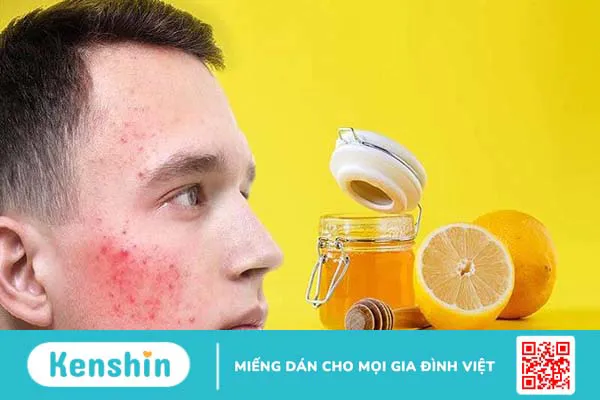 Công dụng, cách dùng mật ong trong làm đẹp