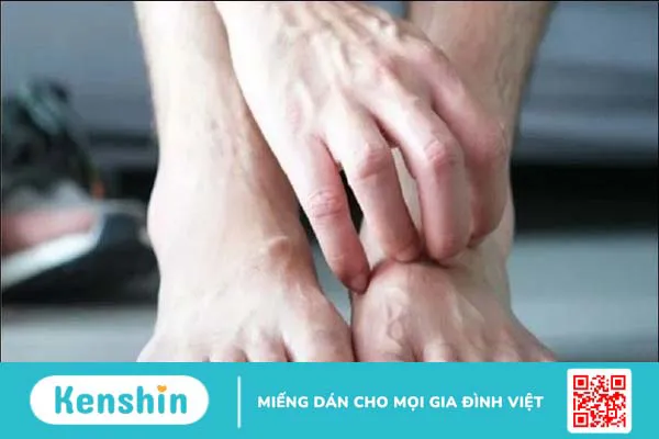 Dấu hiệu ở chân cảnh báo bệnh tiểu đường: Cách nhận biết và phòng ngừa